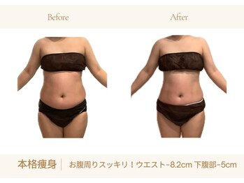 アランルージュ(ALANROUGE)/劇的★ビフォーアフター