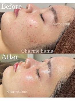 シャルム(Charme.)/