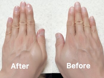 【ネイル】Before/After 