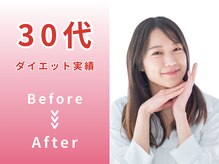 恵整骨院/30代 ダイエットBefore/After