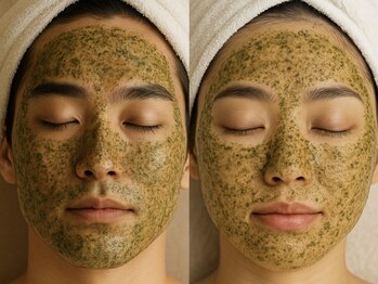 ムギムギ(mugi mugi)の写真/ 【今だけ全員対象】話題の剥離なし肌質改善でモチモチつるん肌へ◎ハーブピーリング5000円