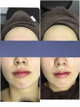 ビー 銀座一丁目駅店(Bee)/