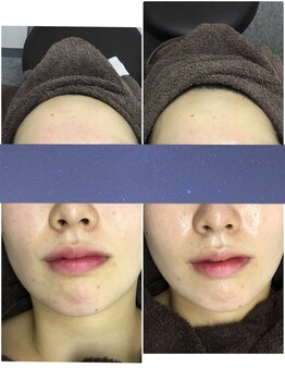 ビー 銀座一丁目駅店(Bee)/