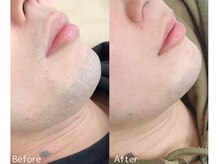 シェリア(Cherien)の雰囲気（メンズの脱毛も大歓迎です◎）