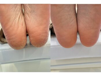 キラネイル アンド アイラッシュ by World Beauty(KIRA)/フットケア