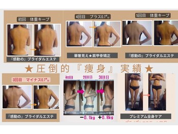 もみほぐし～ぷカンバラ(KAMBARA)の写真/結果重視のブライダルエステ！二の腕・首長・肩甲骨メイクで輝く花嫁へ☆実績多数◎