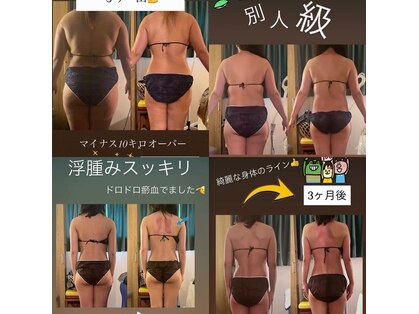 ジパディー (Zip-a-dee)の写真