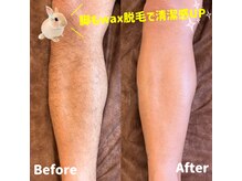ココカナ(COCOKANA)/脚wax脱毛ビフォーアフター