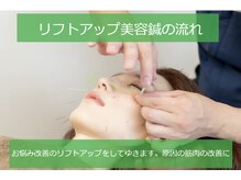 慧仁治療院/リフトアップ美容鍼の流れ