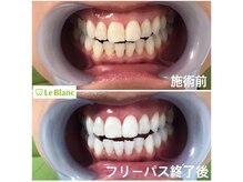 ルブラン 奈良店(Le Blanc)/一番リーズナブルなコース