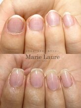 マリーロール 淀屋橋本店(Marie Laure)/自爪育成/深爪矯正/ネイルケア