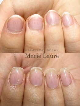 マリーロール 淀屋橋本店(Marie Laure)/自爪育成/深爪矯正/ネイルケア