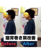 ヒデ整体院(Hide整体院)/猫背矯正骨盤矯正B/A肩こり腰痛