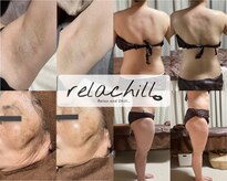リラチル(relachill)