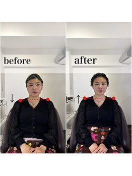 エメ 倉敷店(Aimer)/骨格補正ヘッドスパ 姿勢改善