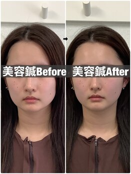 ハリサロンドオフ 堺東店(hari salon de off)/お客様before→after