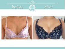 美人バスト 新潟店/ 【バストアップ★育乳】症例