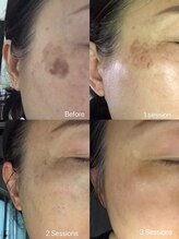 ココノワ(coconoix)/ホワイトラボ