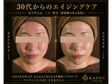 カヨン 新所沢店(KAYON)の雰囲気（たるみを引き上げ、年齢肌にアプローチ。【小顔/毛穴】）