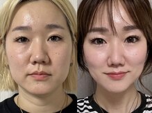 ソワラ 札幌の雰囲気(【小顔/ハーブピーリング】年齢を重ねたお悩みも◎札幌/清田区)
