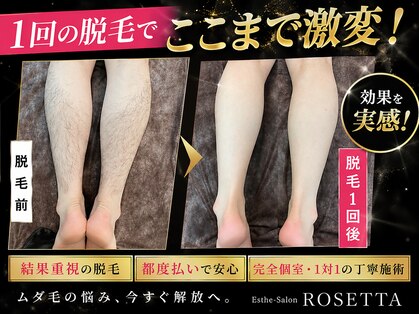 エステサロン ロゼッタ(ROSETTA)の写真