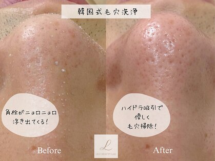 リル ビューティー ラボ(LILU BEAUTY LAB)の写真