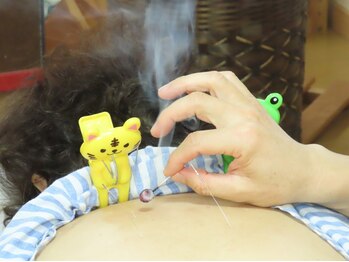 安達カイロプラクティックオフィス/☆鍼灸施術☆