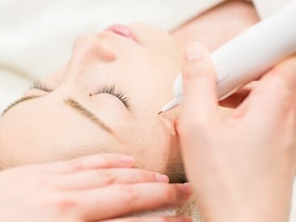 じゅえるの写真