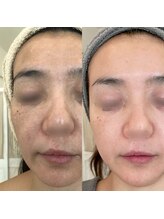 グレーシス(Graces)/お肌悩み諦めないで！