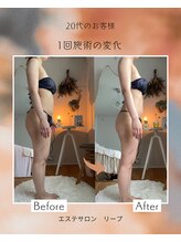 リープ(lieb)/お客様before→after