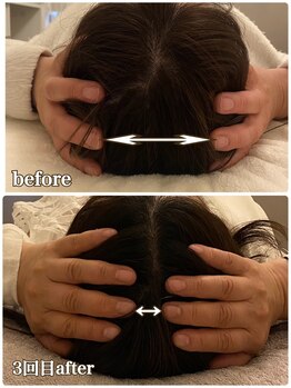 フラン(franc)/施術3回　むくみでお悩みの方へ