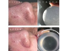 クレア 国際通りカーゴス店(CREA)の雰囲気（毛穴洗浄でお顔、頭皮もスッキリ。）