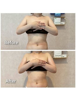 エミア(Emia)/全身痩せ×歪み改善◎120分 １回