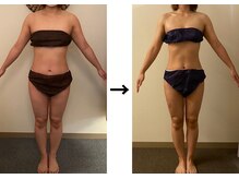 ドクターエイジレス(DR.AGELESS)/食べファスコース1ヶ月/4ヶ月