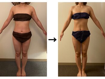 ドクターエイジレス(DR.AGELESS)/食べファスコース1ヶ月/4ヶ月