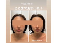ベル(belle)の雰囲気（【belle式小顔術】1回で驚きの効果でスッキリ小顔に♪）