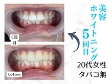 ルカノン(le canon)/近距離でも堂々と笑えます!(^^)!