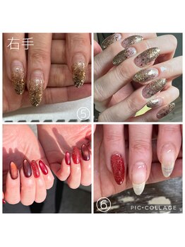 ラモ(RAMO)/ジェルをつけてから半年経過