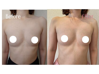 サロンハナ(Salon HANA)の写真
