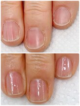 カルカルフット アンド カルネイルサロン(Karu karu foot & Karu nail salon)/ケアで自爪育成【3ヶ月コース】