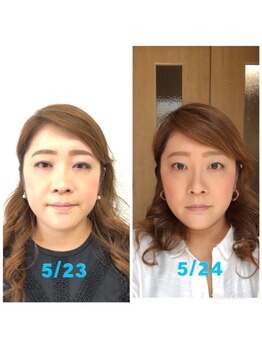 ビューティスタジオＫ/小顔で目尻ググっとリフトアップ