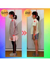 中之口いのまた接骨院/姿勢矯正/子ども猫背矯正