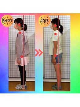 中之口いのまた接骨院/姿勢矯正/子ども猫背矯正