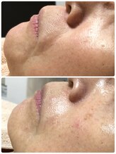 ザ フェース 東京目黒店(THE FAITH)/たるみ改善