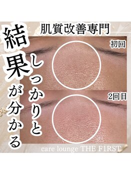 ケア ラウンジ ザ ファースト(THE F1RST)/肌質改善＊ビフォーアフター