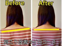 中村カイロプラクティックオフィス アトラス/施術前後での変化！