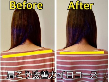 中村カイロプラクティックオフィス アトラス/施術前後での変化！