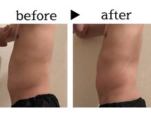 サロン ド ユキフラン(Salon de Yukifranc)/施術部位→お腹・ウエスト