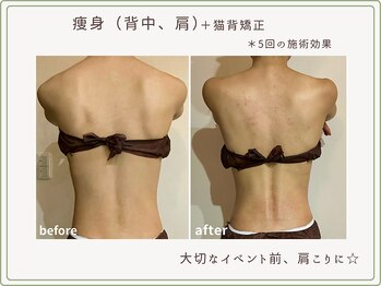 べセラ(BESERA)/痩身・ブライダルエステ