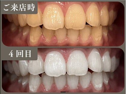 ルミ 星ヶ丘(LUMI)の写真